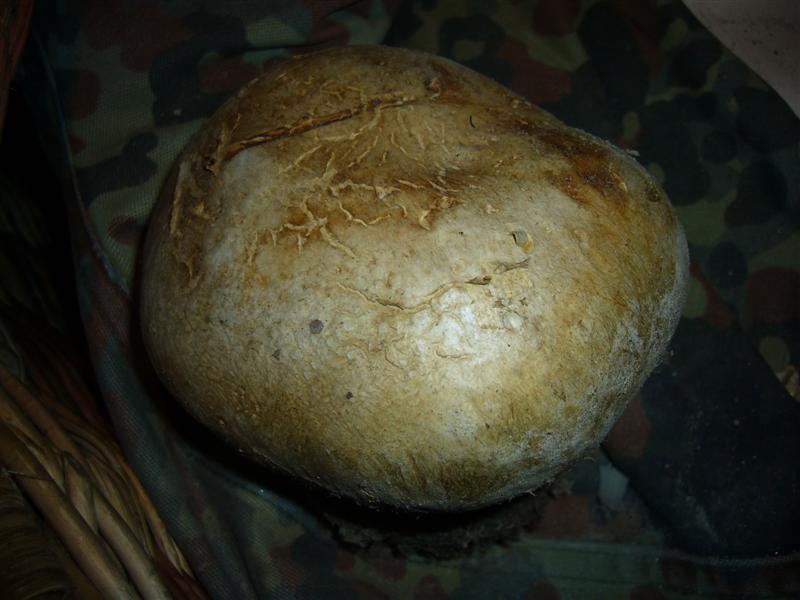 Scleroderma ?